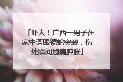 吓人！广西一男子在家中遭眼镜蛇突袭，伤处瞬间剧痛肿胀
